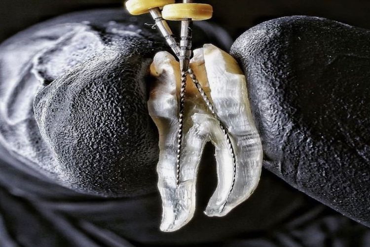 متخصص عصب‌کشی 