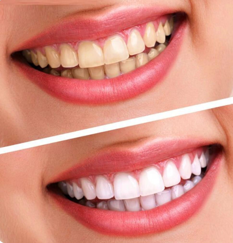 دندانپزشکی زیبایی