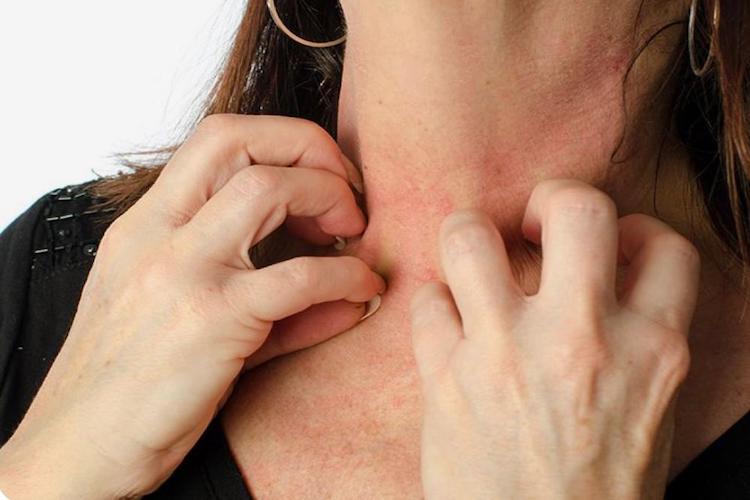 شوک آنافیلاکسی