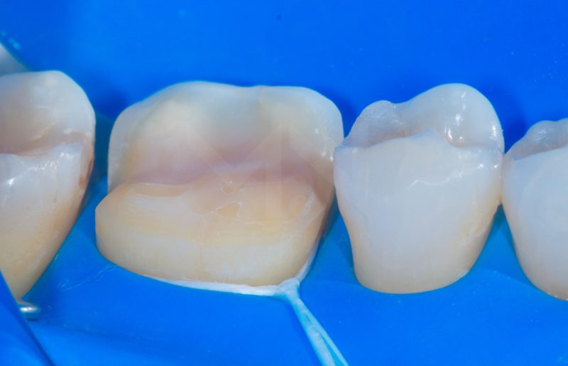 ادونس ادهزیو