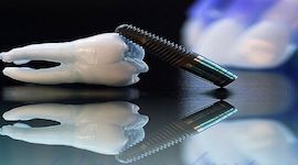 ایمپلنت دندان